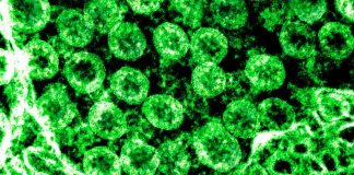 ZLATIBORSKI OKRUG Oporavljeno 17 osoba od početka epidemije